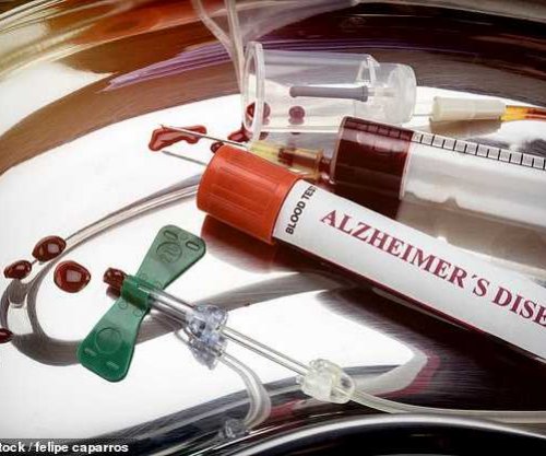 Shkencëtarët zbulojnë se si zhvillohet sëmundja Alzheimer në tru
