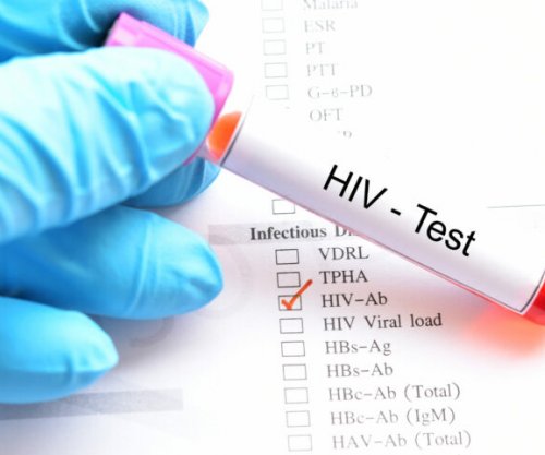 10 raste të reja me HIV në muajt e fundit, rritet testimi vullnetar