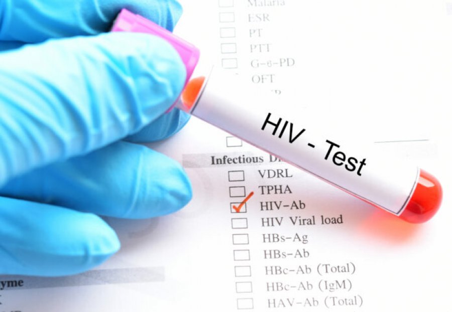 10 raste të reja me HIV në muajt e fundit, rritet testimi vullnetar