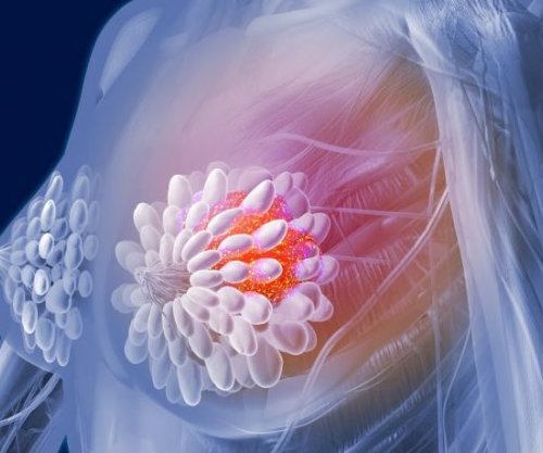 Vajrat e farave lidhen me rritjen e një lloji shumë agresiv të kancerit të gjirit