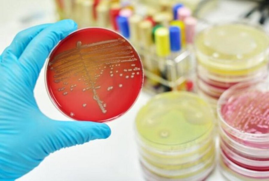 Bakteret ushqimore si Salmonella dhe Kampilobakteri, po bëhen rezistente ndaj antibiotikëve në Evropë