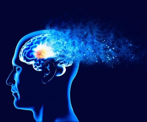 IA parashikon Alzheimerin me një saktësi prej 93%