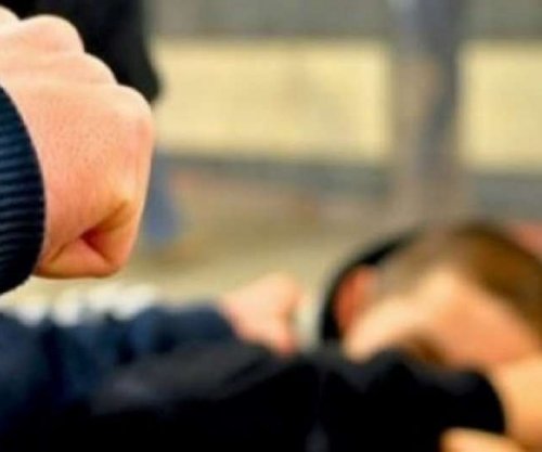 Kërkohet paraburgim për katër të dyshuarit për rrahjen në Ferizaj