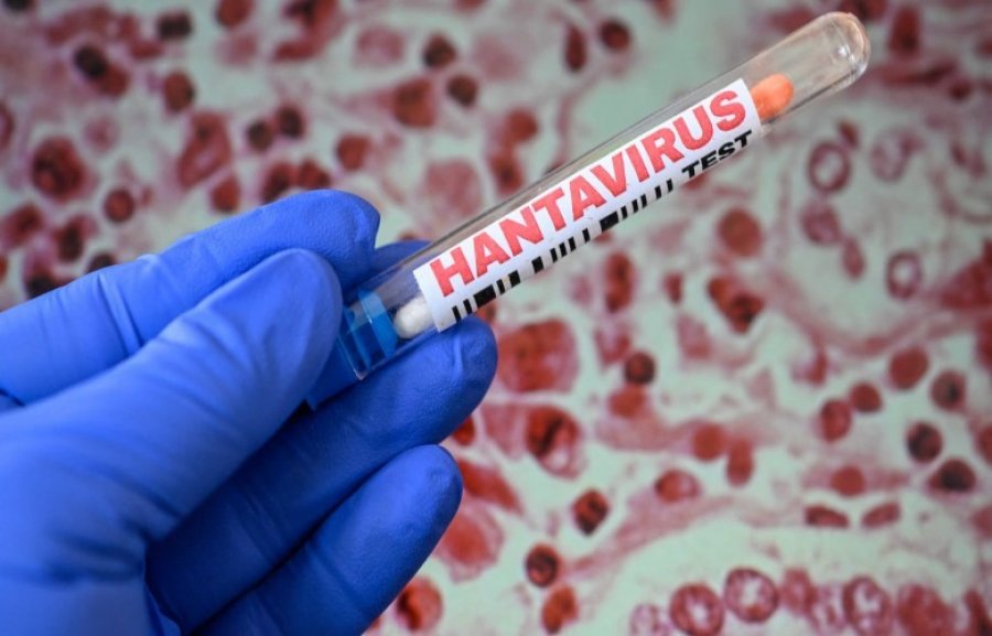 Simaku: Asnjë rast me hantavirus në Shqipëri, rreziku i ulët
