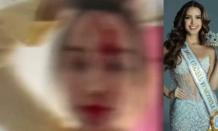 Fytyra e mbuluar me gjak - dhunohet “Miss Venezuela”, arrestohet stilisti i njohur