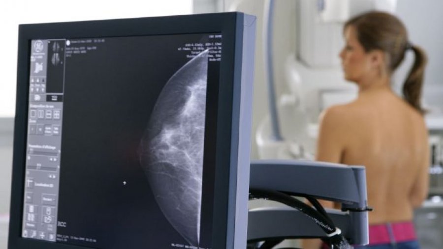 Revolucion në onkologji: Kimioterapia mund të shmanget në dy të tretat e rasteve