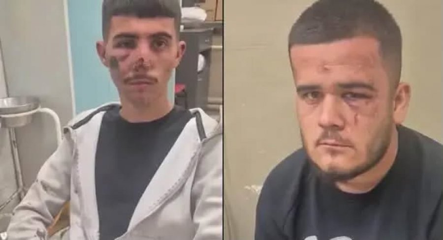 Elmazi dënon dhunën ndaj dy të rinjve shqiptarë nga policia maqedone